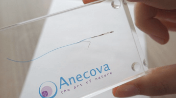 Νέα τεχνική IVF: “Φυσική” γονιμοποίηση σε κάψουλα εντός της μήτρας anecova