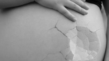 Βρέθηκε ο παράγοντας που συντελεί στη γήρανση των ωαρίων