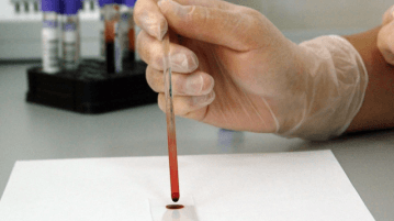 Δωρεάν εξετάσεις HIV και ηπατίτιδας B και C στον Δήμο Θεσσαλονίκης