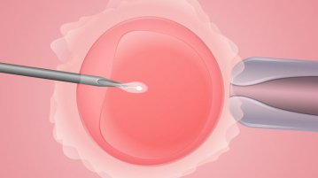 Αντιμετώπιση κολπικών βακτηρίων κατά την εξωσωματική γονιμοποίηση